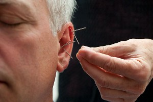 Community Ear Acupuncture @ The June Bug Center | Floyd | Virginia | United States